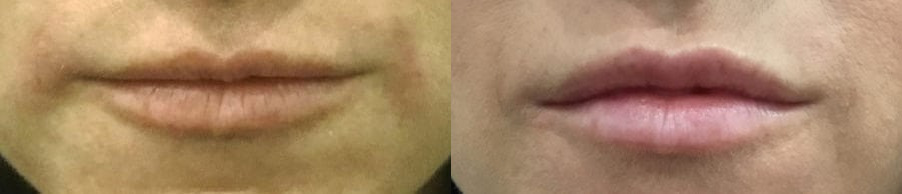 6864 Before and After Photos Melbourne, FL