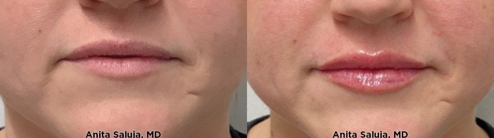 98709 Before and After Photos Melbourne, FL